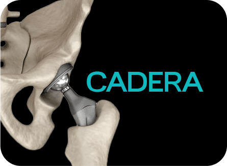 Cadera