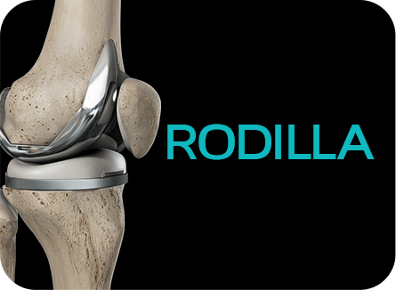 Rodilla